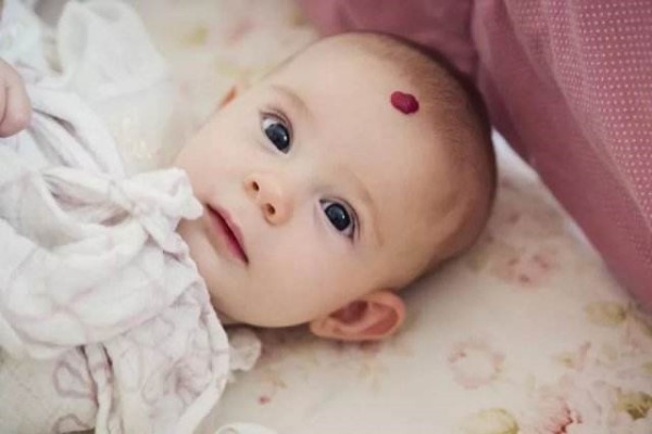 胎记在孕期几个月形成 原来胎记这么早就已经存在了