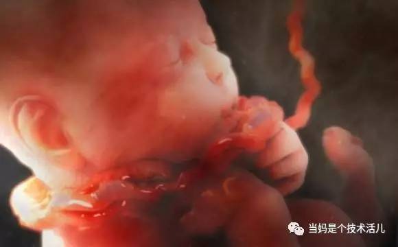 胎儿宫内窒息的3大信号（准妈发现晚胎儿就没命了！）