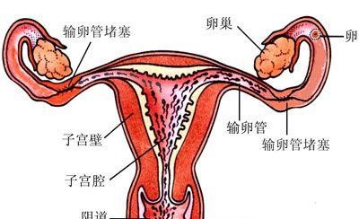 月经不调会导致不孕吗