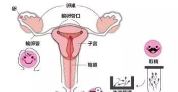 人工受精的大概过程