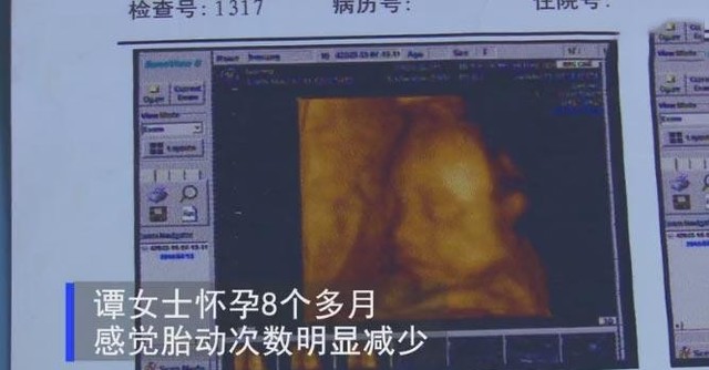 最早几个月有胎动（胎动最早什么时候出现）