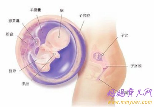 胎儿宫内发育迟缓治疗方案以及新生儿护理