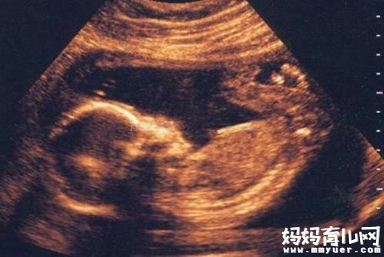 怀孕八个月男胎儿图怎么看 如此辨认男女so easy！
