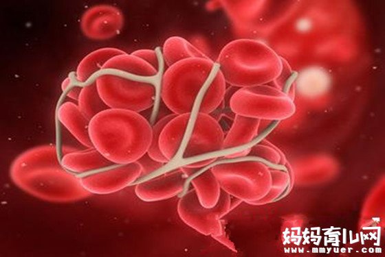 o型血和a型血生的孩子是什么血型 一秒钟读懂！