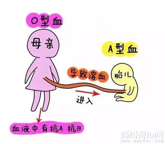 陈妍希怎么安全生孩子 为准妈妈要知道的ABO溶血病