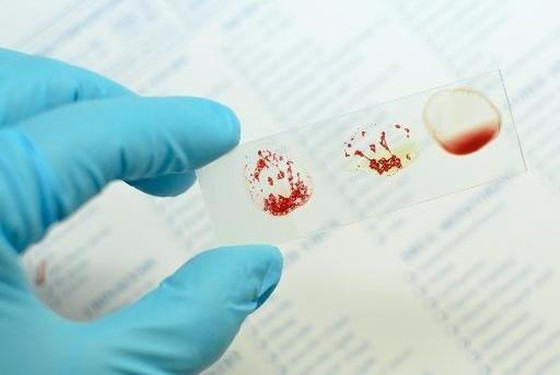 血型影响受孕能力 男人什么血型容易怀孕