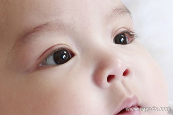 新生儿眼屎多是什么原因引起的？眼屎多又黄又粘稠怎么办？