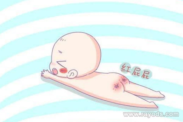 宝宝的红屁股，原因竟是这样导致的