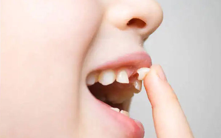 儿童换牙齿的年龄和顺序，换牙过早是不是说明骨龄偏大