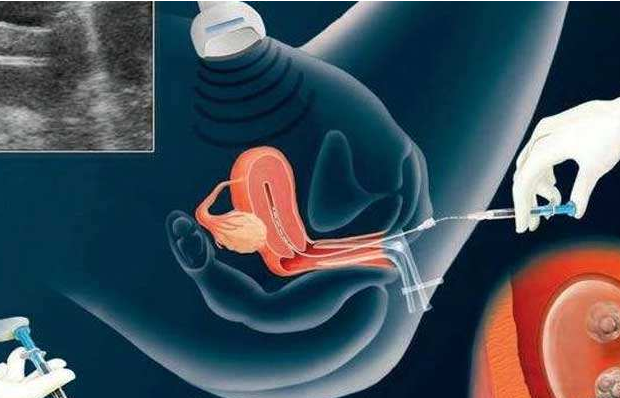 总算是知道为什么说女人做了试管人就废了的真正原因了
