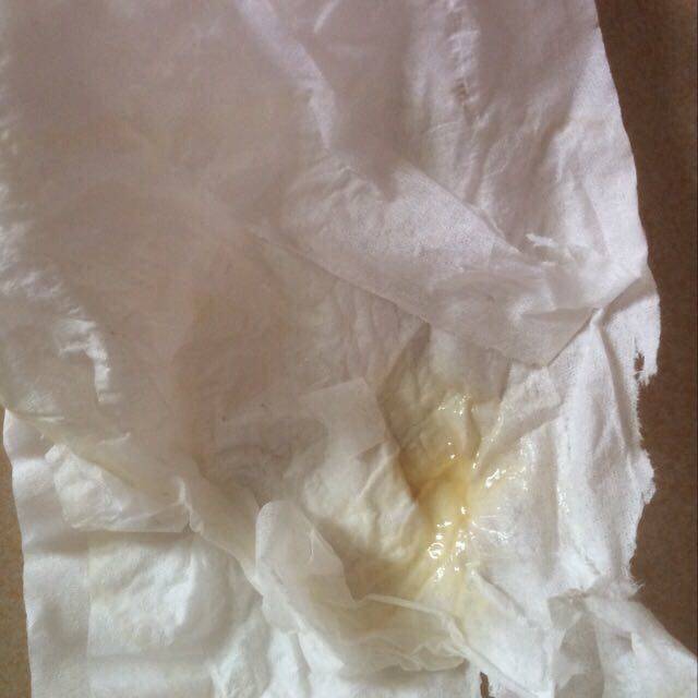 孕期分泌物多是什么原因