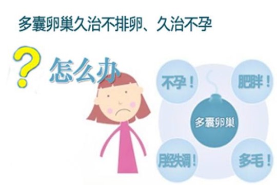 范玮琪昆凌屡“中招” 究竟多囊卵巢综合症怎样治好