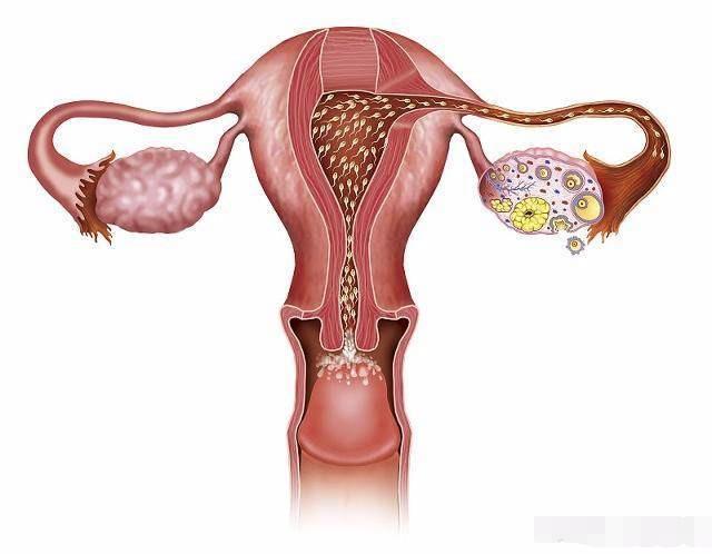 宫外孕是什么原因造成的 宫外孕怎么处理最好