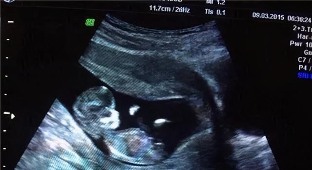 男人为啥要备孕