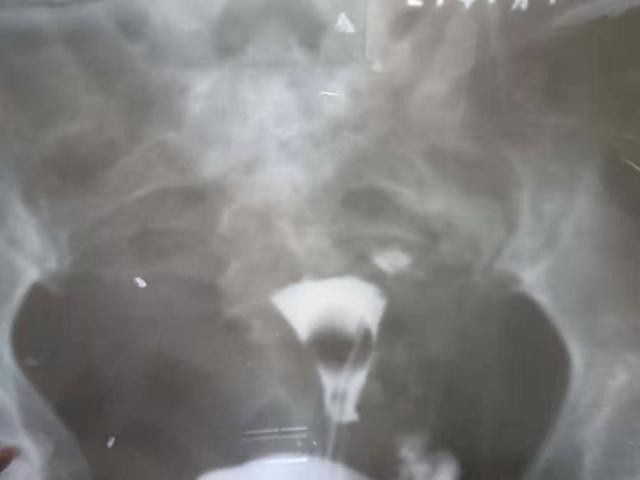 太肥的母鸡不下蛋