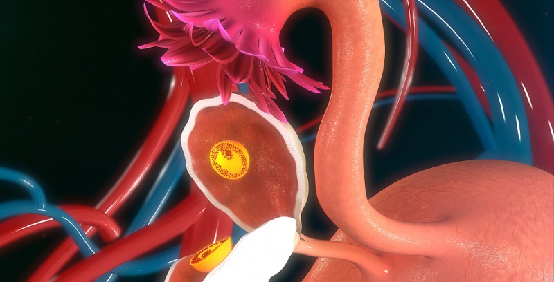 输卵管造影什么时候做（做造影前需要做什么准备）