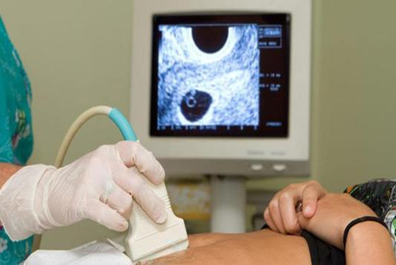 四个方法测怀孕，准爆了，真后悔没早知道