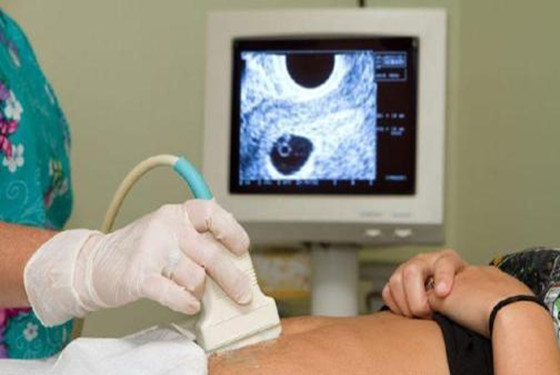 卵泡监测什么时候做 医生给出最靠谱的答案