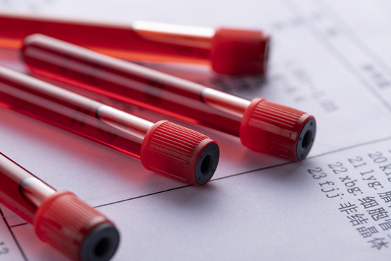 女人什么血型容易怀孕 A血型的MM就偷着乐吧