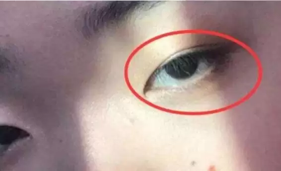 死鱼眼长什么样？教你一眼看出性格和运势