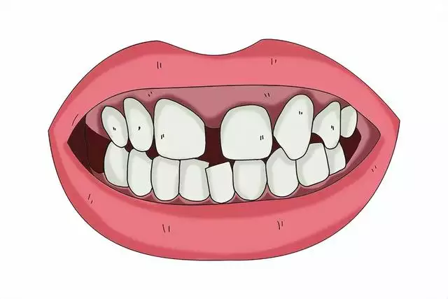 男人牙齿缝隙大对财运、感情与健康的影响