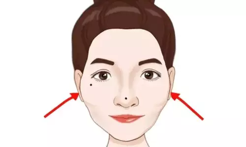 女人颧骨高真的是克夫相吗