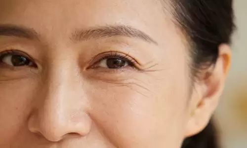 鱼尾纹藏姻缘，一看便知婚姻顺不顺