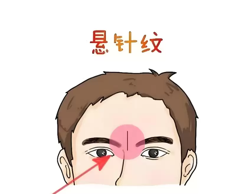 除了悬针纹，眉间这3种竖纹也有讲究