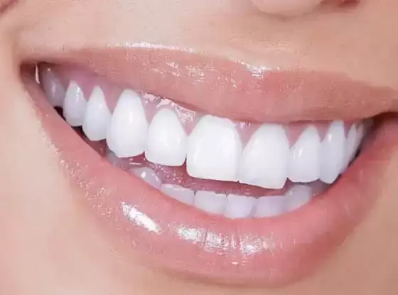 门牙大的人性格和财运如何