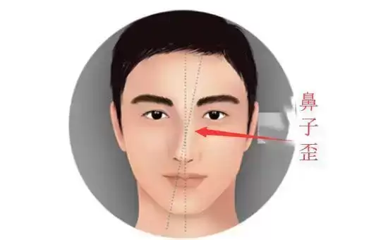 鼻子歪的人面相好不好？一文说清寓意