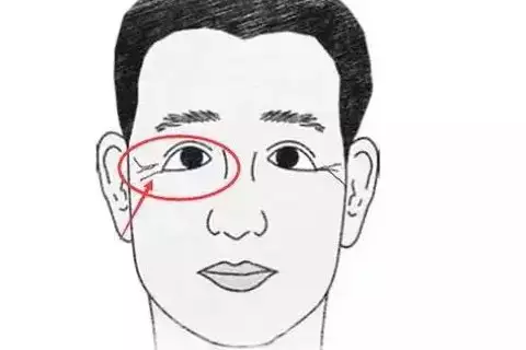 鱼尾纹重的男人都花心吗？花心男人的特征揭秘