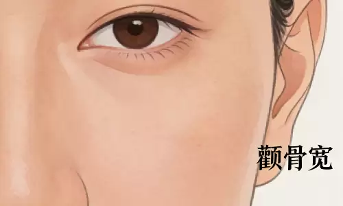 颧骨宽面相如何？别再乱说是克夫相了