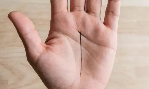 命运线分叉，真的代表人生会走弯路吗