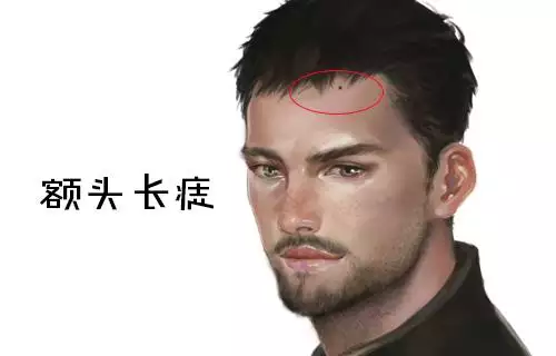 额头左侧的痣意味着什么，揭示命运的隐秘线索