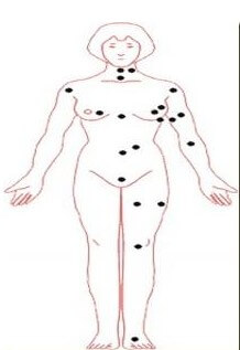 女人脖子前面有痣代表什么 前脖子颈部正中间有痣的女人好吗