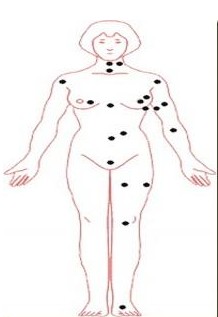 右胸下方有痣好吗女的 右胸下方有痣代表什么