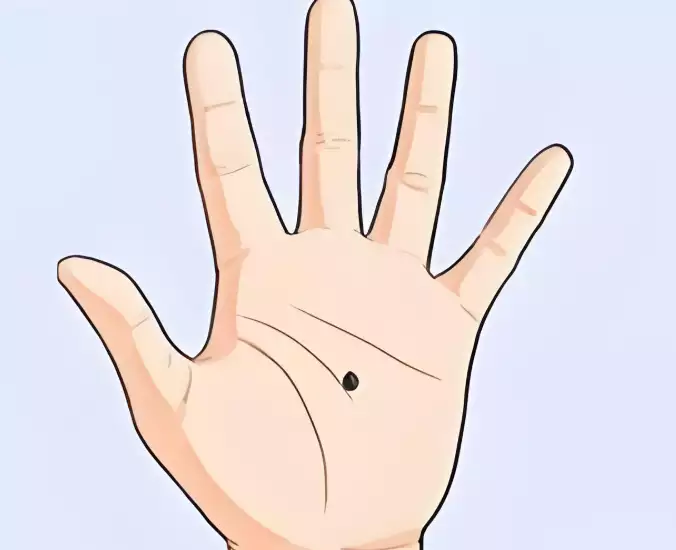 手掌有痣的人运势如何？财富与婚姻全解析