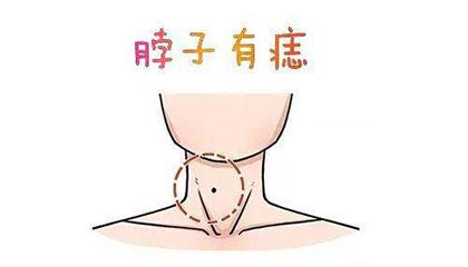 脖子有痣好不好，不同部位有什么代表意思