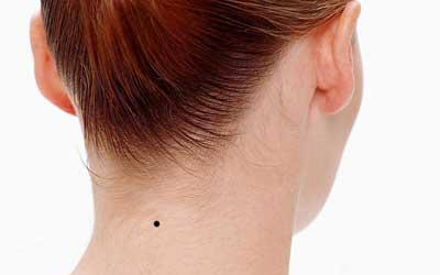 靠山痣与苦情痣的区别，靠山痣在哪个部位？