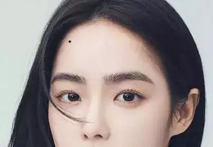 右额黑痣预示着你的运势将迎来飞跃