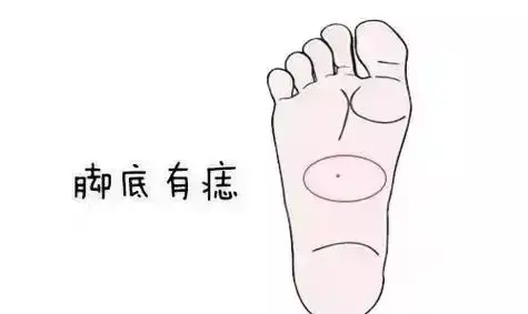 脚心有痣代表什么？揭秘脚底福痣的命运与财富运势