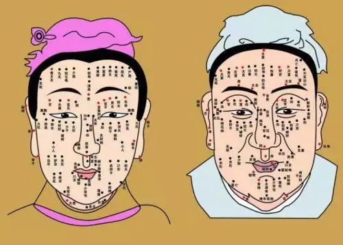 面部的痣哪些不能去除？哪些必须去掉