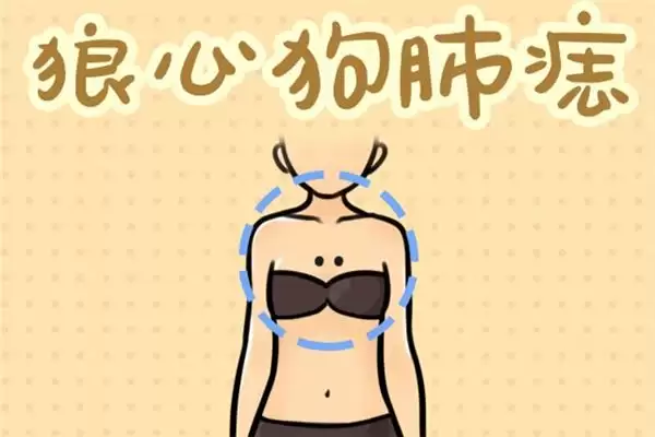有狼心狗肺痣之人是否可靠