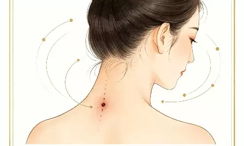 脖子后面有痣代表什么，关乎姻缘财禄走向