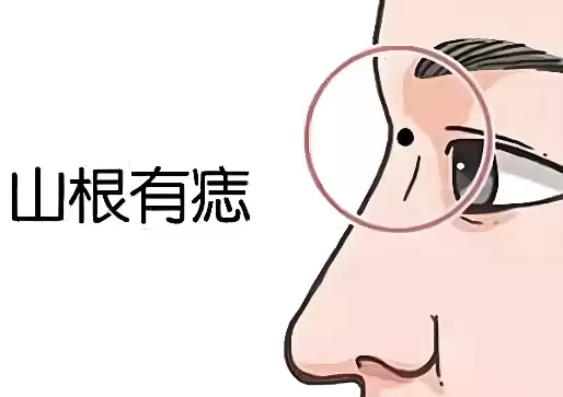 山根有痣究竟是吉是凶？会不会对运气产生影响