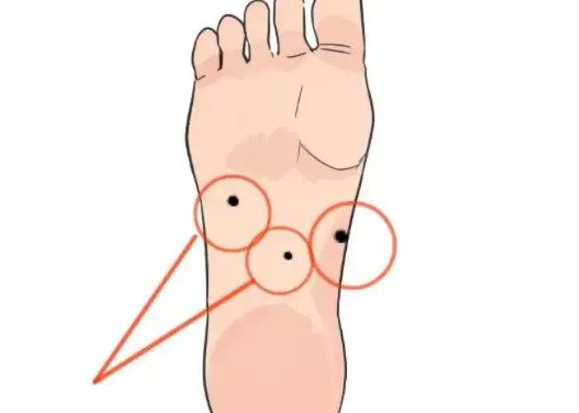 女人脚底有痣代表什么？详解吉凶与运势