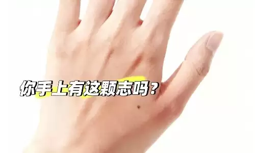手背上有痣，藏着你后半辈子的运势玄机