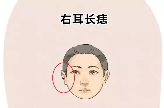 揭示右耳长痣是什么意思