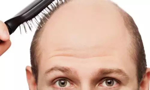 梦见自己秃头是有不好的事发生吗