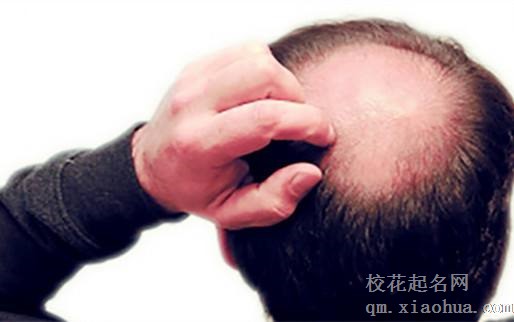 梦见秃顶周公解梦，梦见秃顶是什么意思？